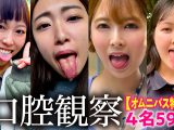 【特価】口腔観察VOL.3 4名59分お買い得セット